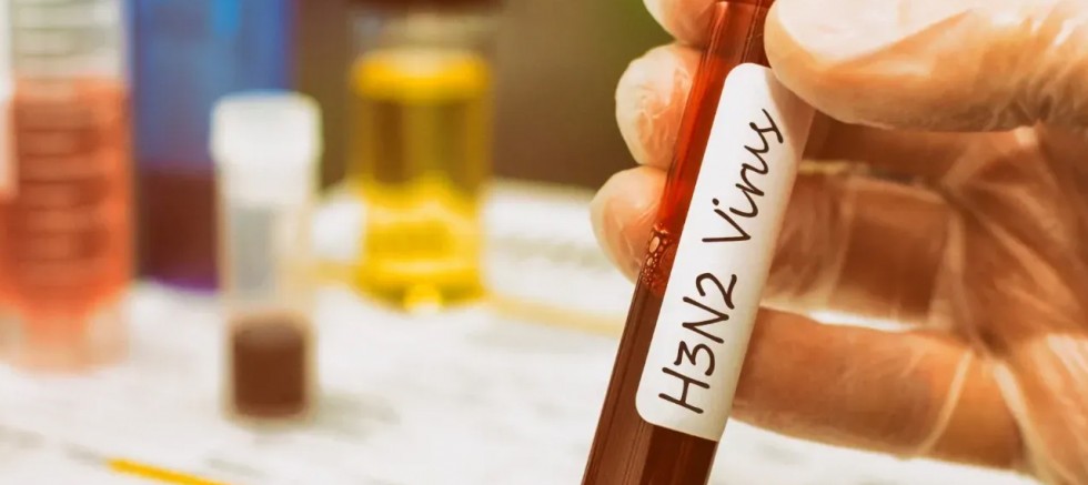 H3N2 Virüsü Nedir? Belirtileri ve Bulaşma Yolları