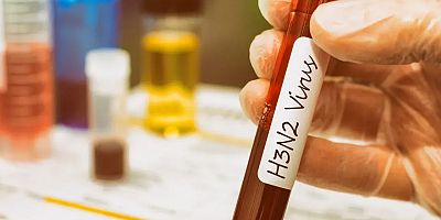 H3N2 Virüsü Nedir? Belirtileri ve Bulaşma Yolları